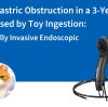 Acute Gastric Obstruction in a 3-Year-Old Cat Caused by Toy Ingestion: A Minimally Invasive Endoscopic Case