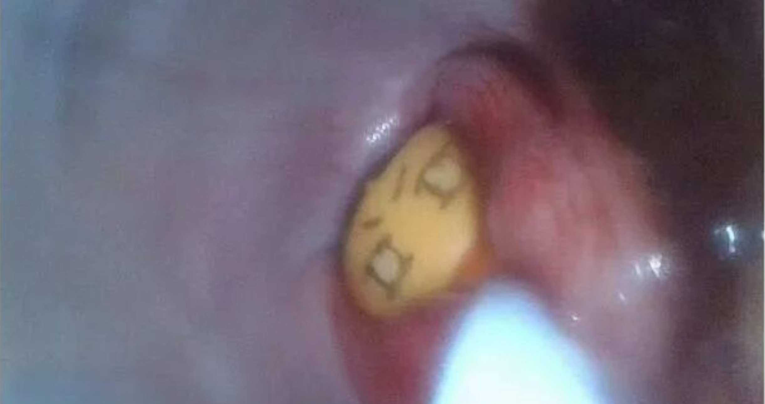 Veterinary Endoscope Case