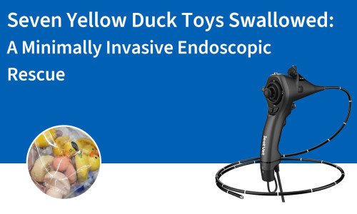 ابتلاع سبع ألعاب بطة صفراء: عملية إنقاذ بالمنظار طفيفة التوغل