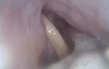 Endoscope canin