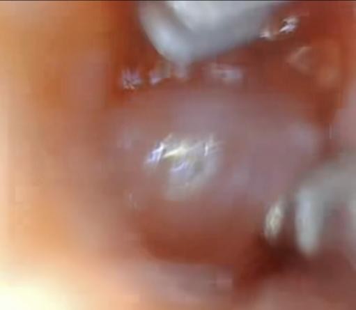 Canine endoscope