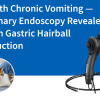Chat souffrant de vomissements chroniques — Une endoscopie vétérinaire a révélé une obstruction gastrique par une boule de poils.