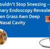 Dog Wouldn't Stop Sneezing — Veterinary Endoscopy Revealed a Hidden Grass Awn Deep in the Nasal Cavity