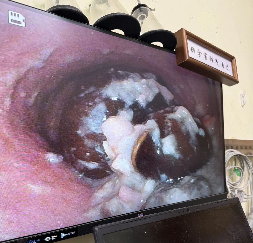 The pig underwent a successful gastroscopic examination using JeetVet’s advanced Veterinary Endoscope.
