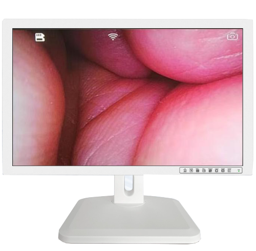 21" Veterinary Endoscopy Monitor | Connected to Endoscopy Workstation and Veterinary Endoscope