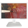 21" Veterinary Endoscopy Monitor | Connected to Endoscopy Workstation and Veterinary Endoscope