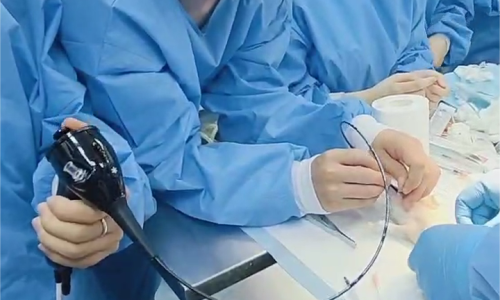 Exploring the Use of Veterinary Endoscopes in Exotic Animal Care