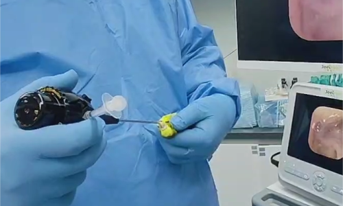 The Power of Endoscopy in Avian Medicine: A Game Changer for Veterinary Care
