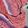 What Should Be Avoided When Using Portable Veterinary Endoscopes?