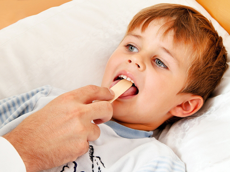 Depresor de lengua de madera Yada, depresores de lengua de madera envueltos individualmente para esterilización