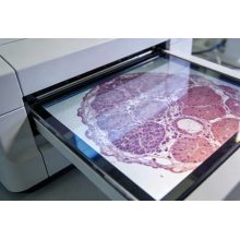 Anti-Glare Medical Display Glass for Medical Imaging & Touch Systems