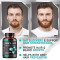 Oranvital Hair Growth Vitamins For Men Anti Hair Loss Pills Regrow Hair Beard Growth Supplement For Volumize Thicker Hair Stop Hair Loss And Thinning Hair