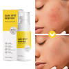 Custom Private Label Removing Spots Whitening Skin Dark Spot Remover
