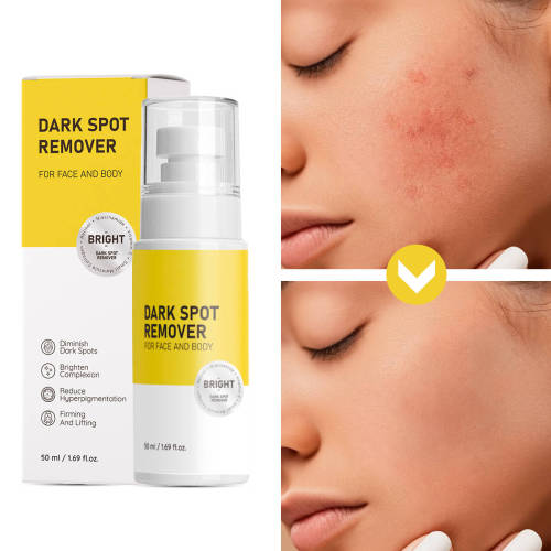 Custom Private Label Removing Spots Whitening Skin Dark Spot Remover