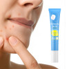 Custom Nourishing Deep Cleansing Acne Removal Gel with Salicylic Acid