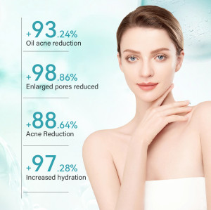 Oil Control Acne Treatment Set Refines Pores Daily Face Care 4-Piece Set