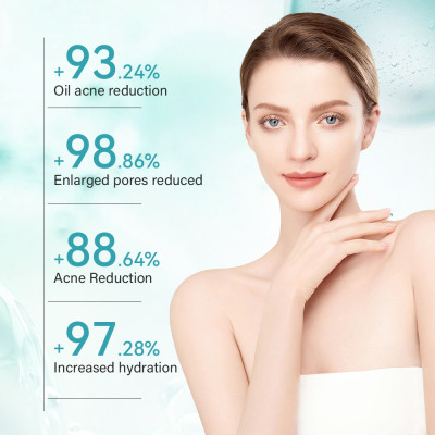 Oil Control Acne Treatment Refines Pores  Salicylic Acid toner cleanser Set