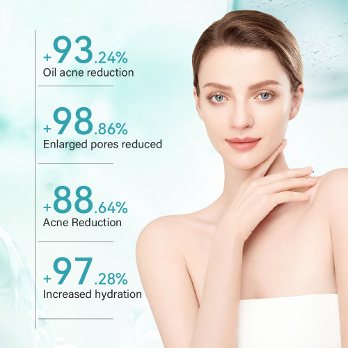 Oil Control Acne Treatment Set Refines Pores Daily Face Care 4-Piece Set