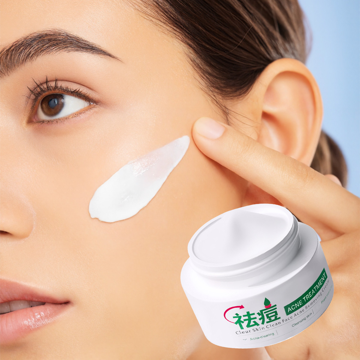 Acne spot removal cream