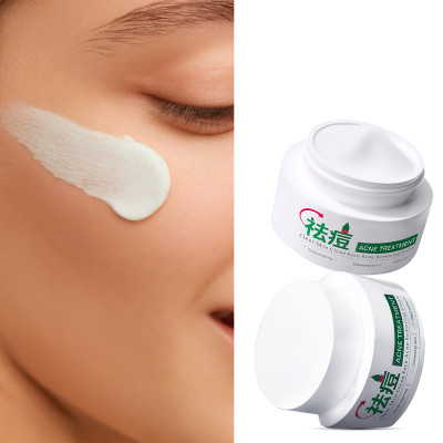 Private Label Facial Care Acne Spot Removal Cream