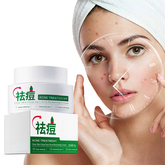 Private Label Facial Care Acne Spot Removal Cream