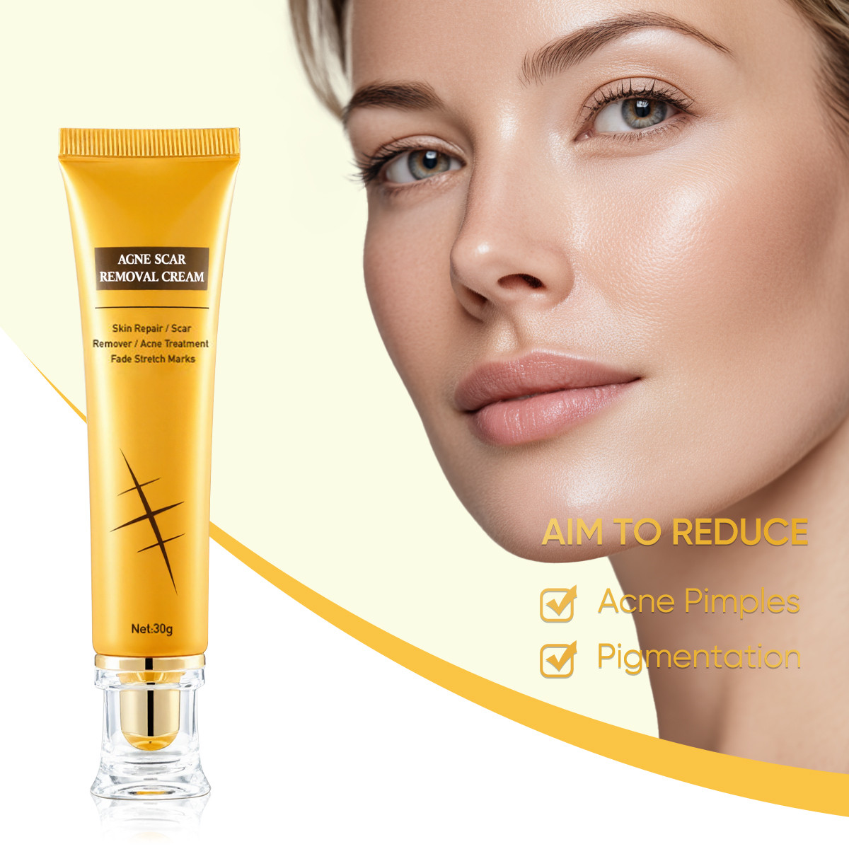 Acne spot removal cream