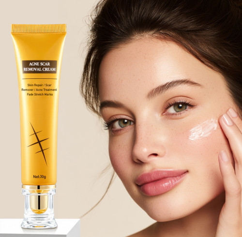 Fast-Acting Moisturizing Acne Spot Marks removal cream