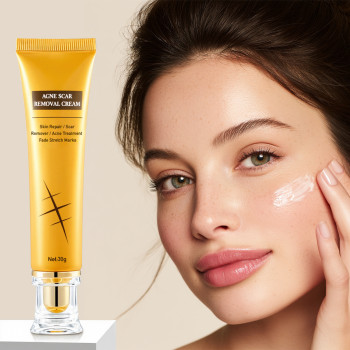 Fast-Acting Moisturizing Acne Spot Marks removal cream
