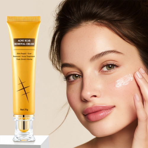Fast-Acting Moisturizing Acne Marks Scar Stretch Repair Prevention Cream