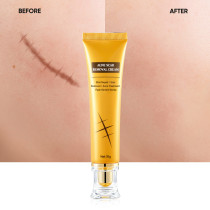 Fast-Acting Moisturizing Acne Spot Marks removal cream