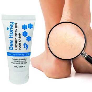 Spa-Grade Deep Hydration Luxury Intensive Foot Crack Prevention Cream