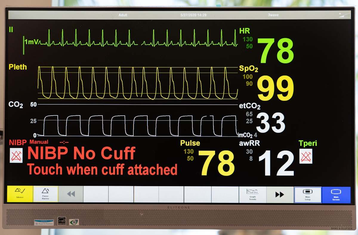 Vital signs display used as part of patient monitoring