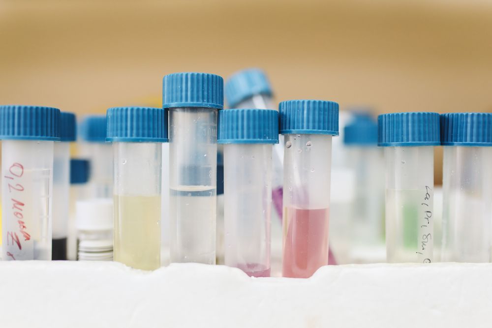 Laboratory test tubes used for chemical testing