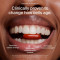 Urolithin A Softgels | Mitochondrial Botanical Nutrition Formula | Dietary Supplement|OEM/ODM